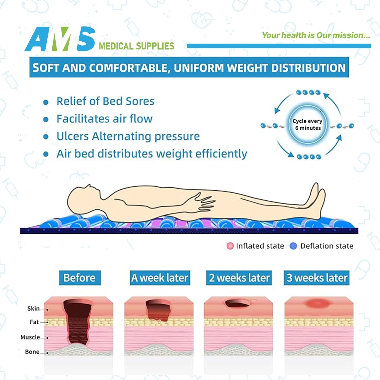 Power-Alternating-Pressure-Mattress-System-5-1.webp Powerمرتبة هوائية مضادة لقرح الفراش من