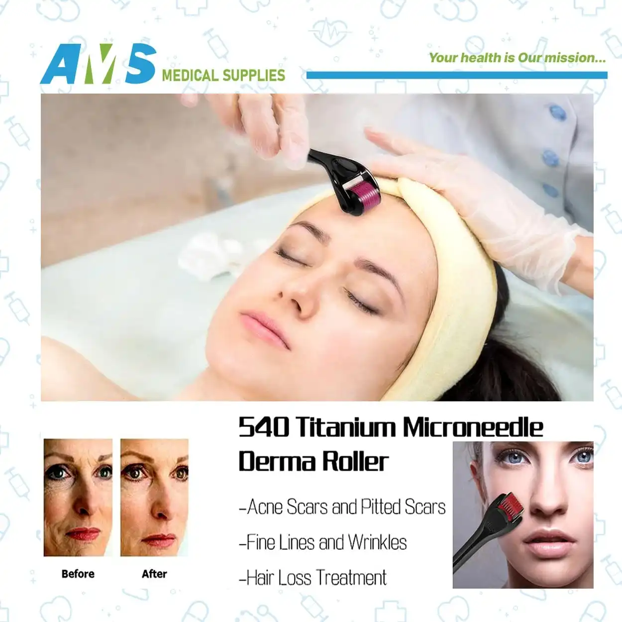 Skin-Roller-System-Size-1.0-mm-3.webp ديرما رولر من سكين مقاس 1.0 ملي